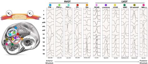 lv summit pvc|rvot free wall pvc.